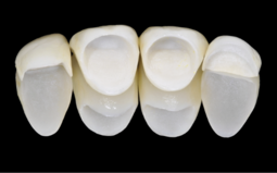 Vitique model